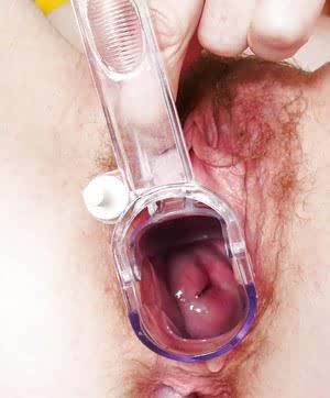 Stocking clad mature woman inserting speculum into hairy vagina